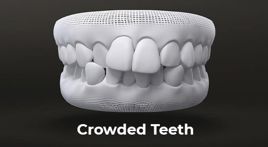 crowded