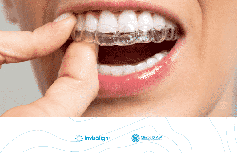 Invisalign México