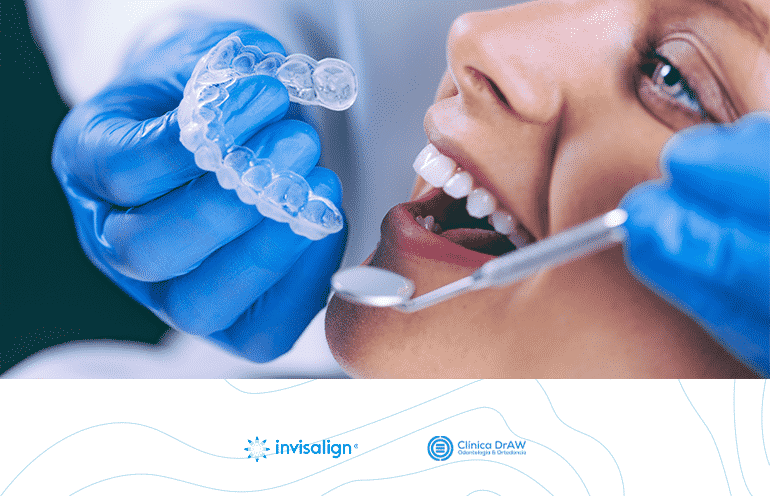 Invisalign México