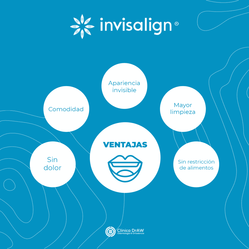 Invisalign Ventajas