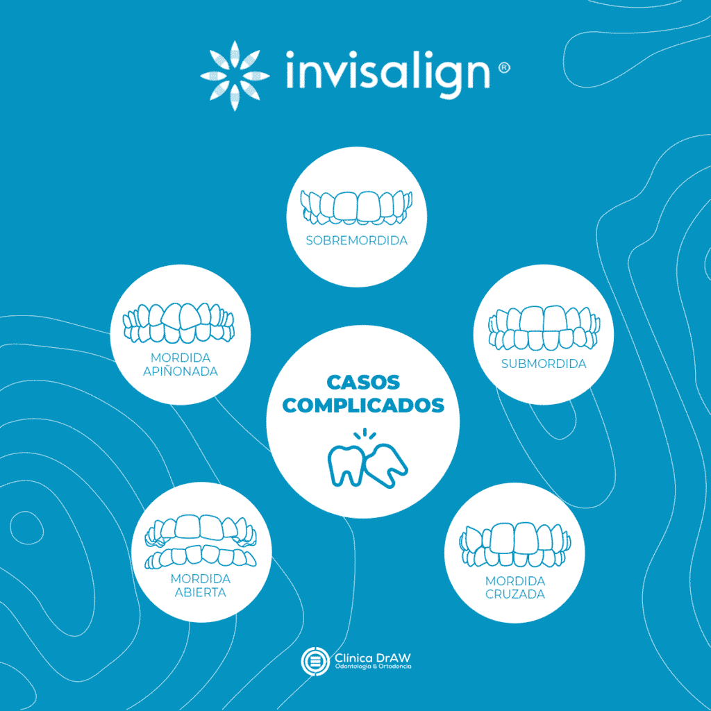 Invisalign Casos Complicados