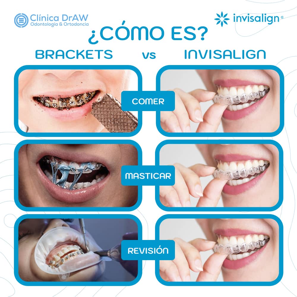 Razones Para Elegir Invisalign vs Brackets Invisalign México Clínica DrAW Dibujando tu